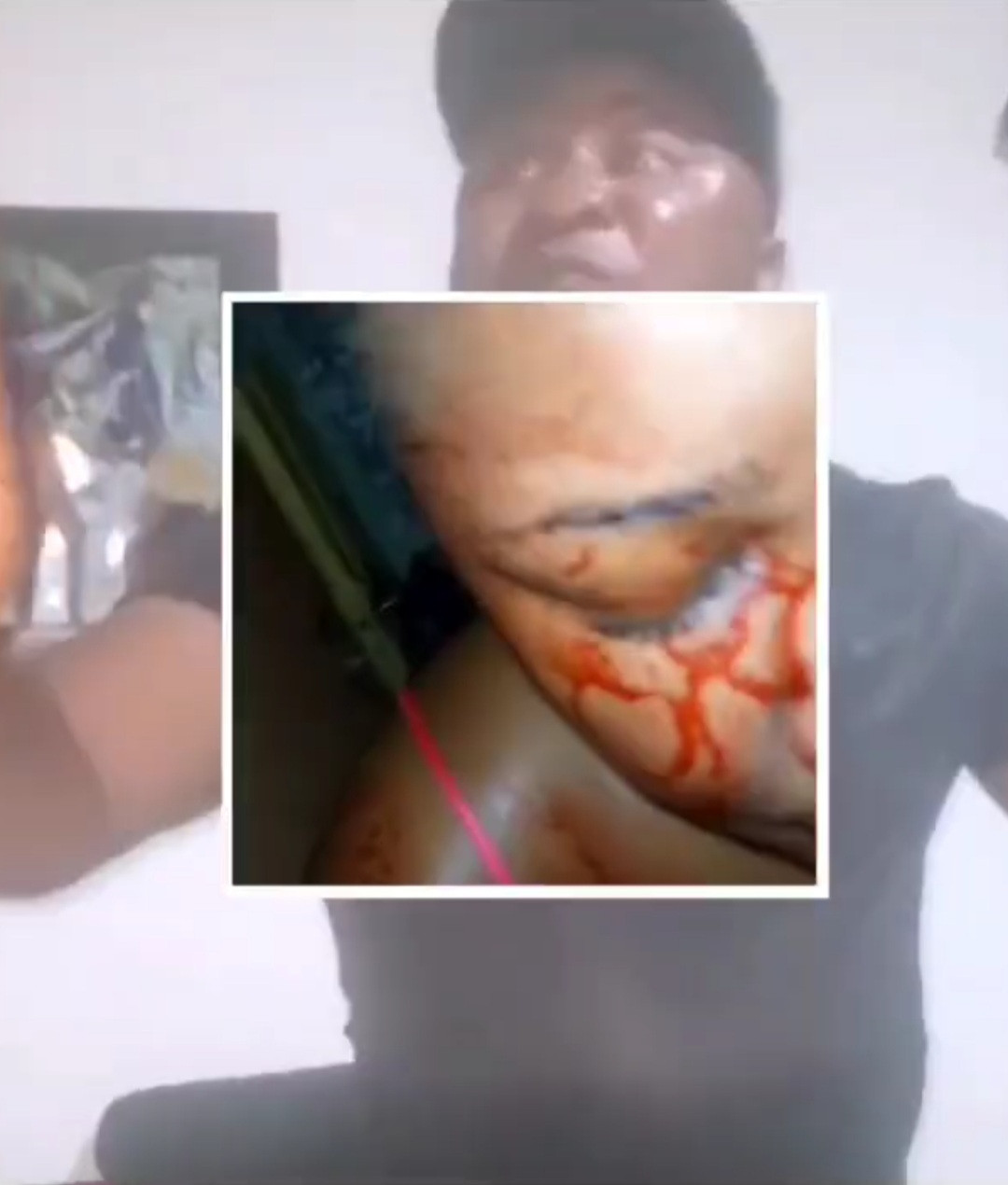 Man allegedly beats up his partner till she bleeds then boasts that he