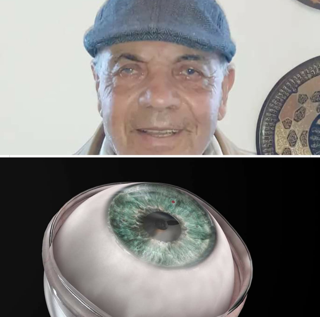 Man who had been blind for a decade regains vision after artificial cornea transplant 