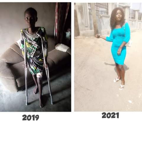 "For 6 months on the sickbed my boyfriend never checked up on me, I lost a lot of friends" - Nigerian lady shares her story of recovery 