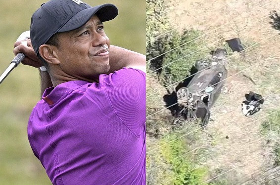 Golf legend, Tiger Woods hospitalized with 