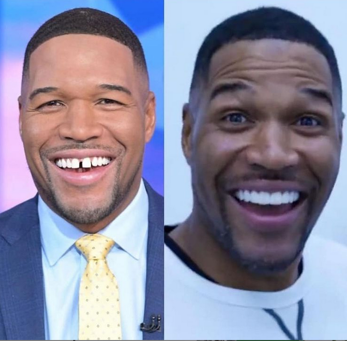Former NFL player, Michael Strahan closes his signature tooth gap (video)