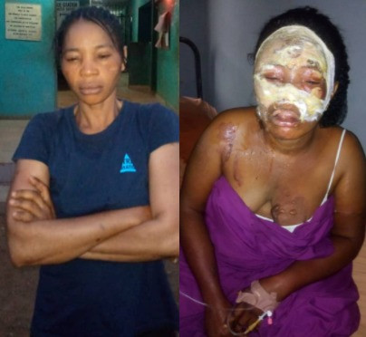Single mum of two arrested for pouring hot water on woman who accused her of dating her husband (photos)