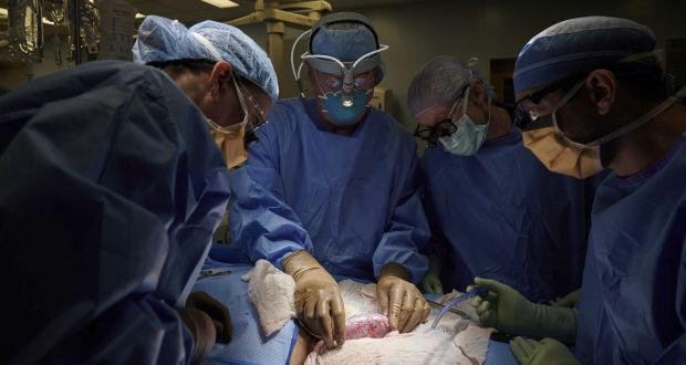 US surgeons successfully attach a pig kidney to a human and it worked