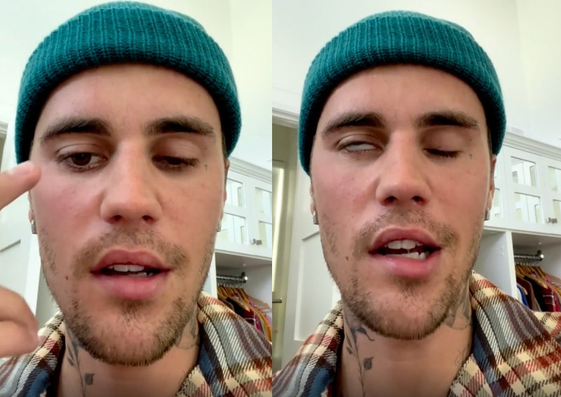 I know this storm will pass, Jesus is with me - Justin Bieber speaks on struggle with facial paralysis