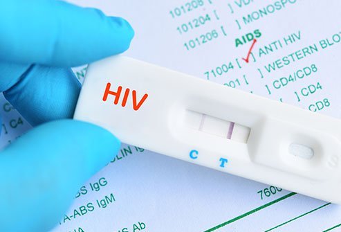 man test positive for hiv